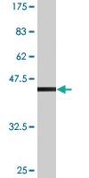 Anti-RAC2 Mouse Monoclonal Antibody [clone: M1]