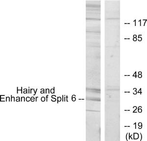 Western blot analysis of lysates from HeLa cells using Anti-HES6 Antibody. The right hand lane represents a negative control, where the antibody is blocked by the immunising peptide