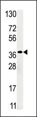 Anti-RBKS (RBSK) Rabbit Polyclonal Antibody