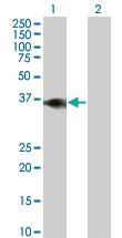 Anti-BOLL Mouse Monoclonal Antibody [clone: 1G8]