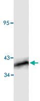 Anti-NFKBIB Rabbit Polyclonal Antibody