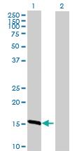 Anti-TXNL4B Mouse Polyclonal Antibody