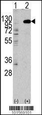 Anti-FGFR2 Rabbit Polyclonal Antibody (Biotin)