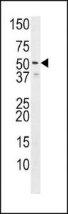 Anti-HRH3 Rabbit Polyclonal Antibody (AP (Alkaline Phosphatase))