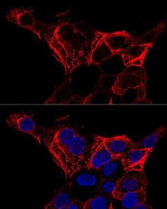 Anti-Cytokeratin 20 antibody