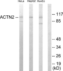 Western blot analysis of lysates from HepG HeLa, and HUVEC cells using Anti-alpha Actinin 2 + 3 Antibody The right hand lane represents a negative control, where the antibody is blocked by the immunising peptide