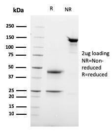 SDS-PAGE analysis of Anti-Desmoglein 3 Antibody [DSG3/2837] under non-reduced and reduced conditions; showing intact IgG and intact heavy and light chains, respectively SDS-PAGE analysis confirms the integrity and purity of the antibody