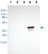 Anti-OTC Rabbit Polyclonal Antibody