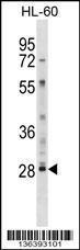 Anti-LY6G6F Rabbit Polyclonal Antibody (APC (Allophycocyanin))