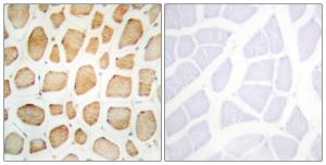 Immunohistochemical analysis of paraffin-embedded human skeletal muscle tissue using Anti-alpha Actinin 2 + 3 Antibody The right hand panel represents a negative control, where the antibody was pre-incubated with the immunising peptide