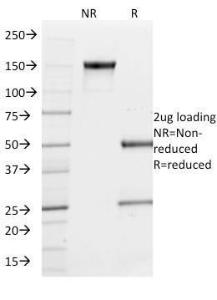 SDS-PAGE analysis of Anti-PU.1 Antibody [PU1/2146] under non-reduced and reduced conditions; showing intact IgG and intact heavy and light chains, respectively. SDS-PAGE analysis confirms the integrity and purity of the antibody