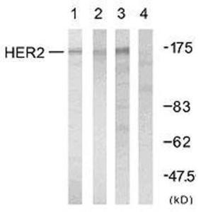 Western blot analysis of lysates from A2780 cells using Anti-HER2 Antibody. The right hand lane represents a negative control, where the antibody is blocked by the immunising peptide