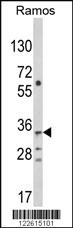 Anti-TBATA Rabbit Polyclonal Antibody