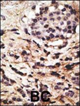 Anti-BECN1 Rabbit Polyclonal Antibody (Biotin)