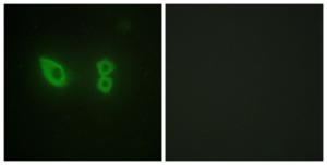 Immunofluorescence analysis of HeLa cells using Anti-alpha Actinin 2 + 3 Antibody The right hand panel represents a negative control, where the antibody was pre-incubated with the immunising peptide