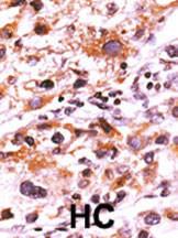 Anti-FGFR Rabbit Polyclonal Antibody (AP (Alkaline Phosphatase))