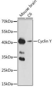 Western blot analysis of extracts of various cell lines, using Anti-Cyclin Y Antibody (A308203) at 1:1,000 dilution