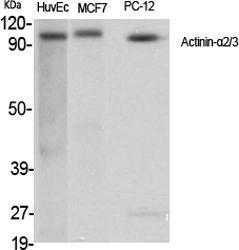 Western blot analysis of various cells using Anti-alpha Actinin 2 + 3 Antibody