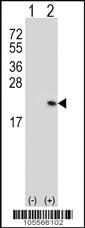 Anti-RFK Rabbit Polyclonal Antibody