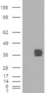 HEK293 overexpressing CD32 (RC211982) and probed with EB06695 (mock transfection in first lane), tested by Origene.