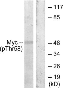 Western blot analysis of lysates from ovary cancer using Anti-Myc (phospho Thr58) Antibody. The right hand lane represents a negative control, where the antibody is blocked by the immunising peptide.