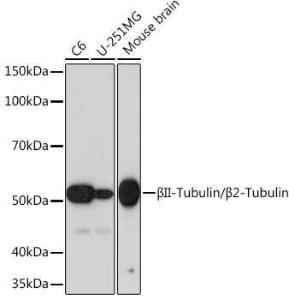 Anti-beta II Tubulin Rabbit Monoclonal Antibody [clone: ARC0227]