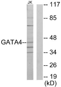 Western blot analysis of lysates from Jurkat cells using Anti-GATA4 Antibody. The right hand lane represents a negative control, where the antibody is blocked by the immunising peptide