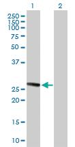 Anti-TMED1 Mouse Polyclonal Antibody