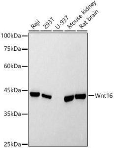 Western blot analysis of extracts of various cell lines, using Anti-Wnt16 Antibody [ARC2862] (A307164) at 1:500 dilution. The secondary Antibody was Goat Anti-Rabbit IgG H&L Antibody (HRP) at 1:10000 dilution. Lysates/proteins were present at 25 µg per lane