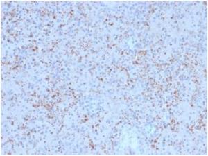 Anti-SPARC antibody