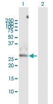 Anti-KHK Rabbit Polyclonal Antibody