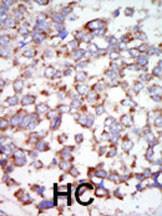 Anti-MAP3K7 Rabbit Polyclonal Antibody (PE (Phycoerythrin))