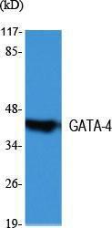 Western blot analysis of various cells using Anti-GATA4 Antibody