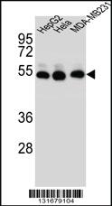 Anti-TUBB2B Rabbit Polyclonal Antibody