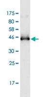 Anti-RAC2 Mouse Monoclonal Antibody [clone: 3B8]