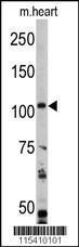 Anti-PIK3CA Rabbit Polyclonal Antibody (Biotin)