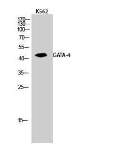 Western blot analysis of K562 cells using Anti-GATA4 Antibody