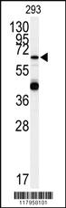 Anti-EXOC6B Rabbit Polyclonal Antibody