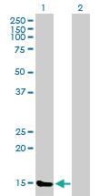 Anti-TXNL4B Mouse Polyclonal Antibody