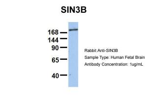 Anti-SIN3B Rabbit Polyclonal Antibody