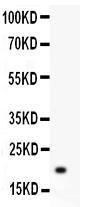 Anti-JunB Polyclonal Antibody