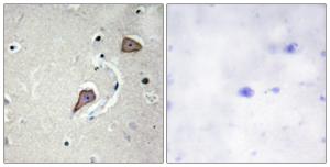 Immunohistochemical analysis of paraffin-embedded human brain tissue using Anti-HER2 Antibody. The right hand panel represents a negative control, where the antibody was pre-incubated with the immunising peptide