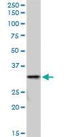 Anti-SULT1A3 Mouse Polyclonal Antibody