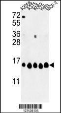 Anti-Histone H2A/s Rabbit Polyclonal Antibody (AP (Alkaline Phosphatase))