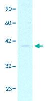 Anti-GTF2B Rabbit Polyclonal Antibody