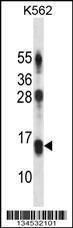 Anti-LY86 Rabbit Polyclonal Antibody (AP (Alkaline Phosphatase))