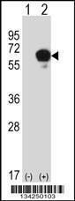 Anti-DPYSL3 Rabbit Polyclonal Antibody