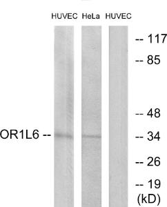 Western blot analysis of lysates from HUVEC and HeLa cells using Anti-OR1L6 Antibody. The right hand lane represents a negative control, where the antibody is blocked by the immunising peptide