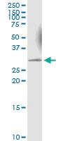 Anti-KHK Rabbit Polyclonal Antibody