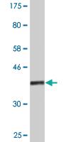 Anti-ASH2L Mouse Monoclonal Antibody [clone: 4G7]